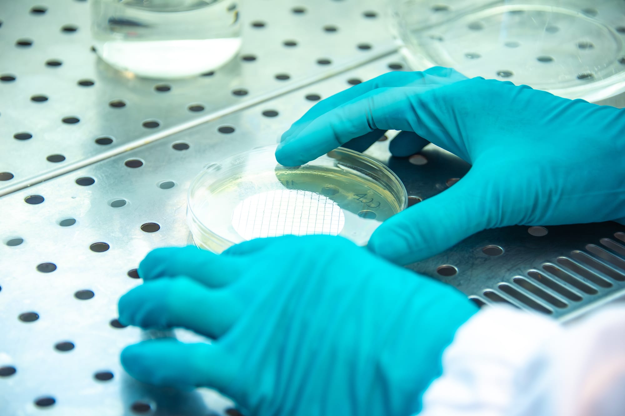 Europe not on track to meet four of five AMR targets