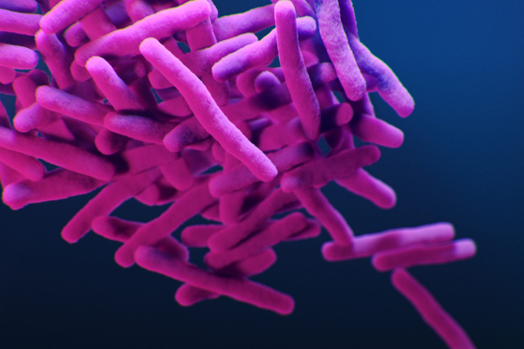 EU/EEA falls short on TB detection as one in five cases go unnoticed