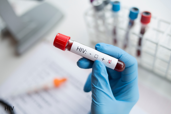 EU missing out on the benefits of early HIV and hepatitis diagnosis