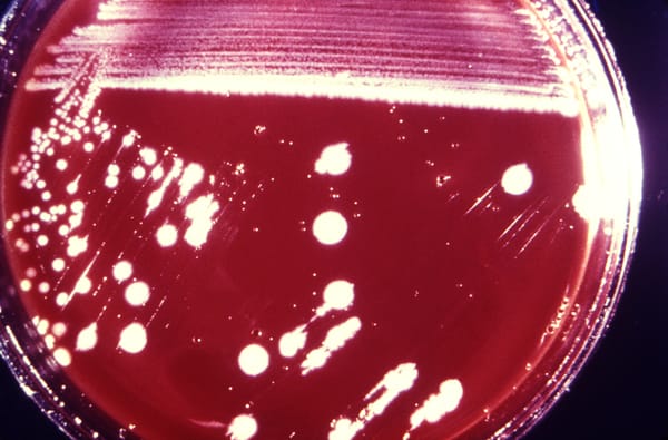 Listeria remains Europe's most lethal foodborne threat